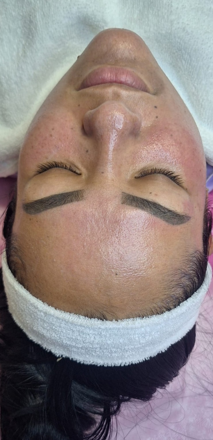 Rostro de una clienta al terminar una higiene facial en cabina